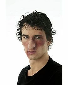 Woochie Champ Nose Prosthetics